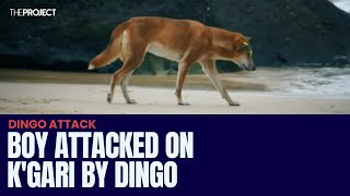 Boy Attacked On KGari By Dingo [upl. by Doe]