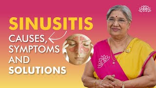 What is Sinusitis  Sinusitis Causes Symptoms amp Treatment  Sinus Infection  Dr Hansaji [upl. by Auqenwahs]