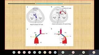 ccTGA Surgical options by Dr Sreevathsa Kadaba [upl. by Frissell644]