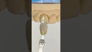 Another Perfectly Shaded Incisor EnvisiontecMain envisiontec lsk121shorts dentist [upl. by Ahcas137]