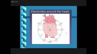 CVS CARDIOLOGYNormal and nonarrhythmias ECG interpretation [upl. by Barcot]