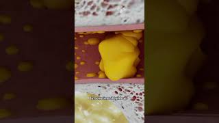 How to Remove Ear Wax Blockage the Right Way shorts facts  creativelearning3d [upl. by Aylmar678]