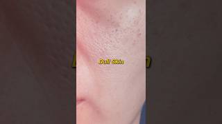 Best Moisturizer for Dull Skin brighteningmoisturiser moisturizer Ad [upl. by Zebe]