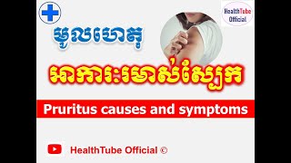 មូលហេតុ អាការៈរមាស់ស្បែក l Pruritus causes and symptoms ll HealthTube Official [upl. by Aoket]