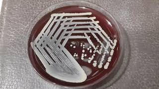 Betahaemolytic colonies of Staphylococcus aureus on blood agar Demonstration [upl. by Ailen191]