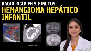 Radiología en 5 minutos Hemangioma Hepático Infantil [upl. by Refenej]