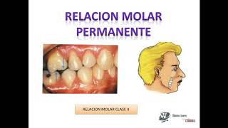 CRITERIOS DE CLASIFICACIÓN EN DENTICIÓN TEMPORAL [upl. by Lounge374]