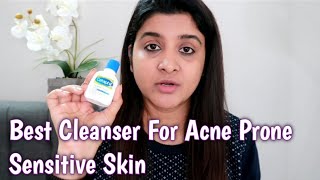 Best Face Cleanser for Acne Prone Sensitive Skin  Cetaphil Face amp Body Gentle Skin Cleanser Review [upl. by Emelina]