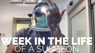 A Week in the Life of a Surgeon [upl. by Akcirderf203]