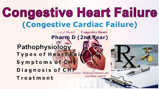 Congestive cardiac failure [upl. by Rexana]