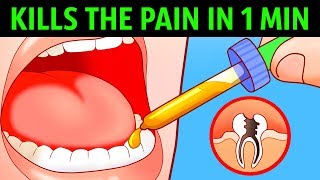 10 Ways to Kill a Toothache In a Minute [upl. by Sirotek]