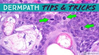 Dermatopathology Practical Tips amp Tricks for Pathology amp Dermatology [upl. by Caldeira301]