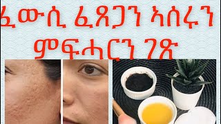 ፈውሲ ፈጸጋ ኣሰር ፈጸጋን ምፍሓር ን ናይ ገጽ ክልተ ዓይነት ትሕዝቶታት💪💯علاج حفرالوجه [upl. by Straub935]