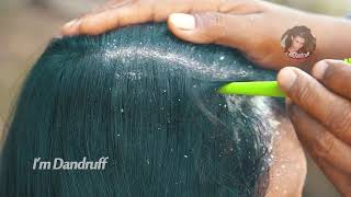 Oddly Satisfying Insane Dandruff Scratching Flakes Scalp Condition Removal After Braids 𝐈𝐌𝐃𝟑𝟗𝟗𝟎𝟗𝟕𝟑 [upl. by Enyak]