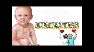 Neurofibromatosis History mrcpch Clinical [upl. by Gilberta997]