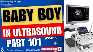 Baby Boy In Ultrasound  A Clear Footage  Part 101 [upl. by Bierman679]