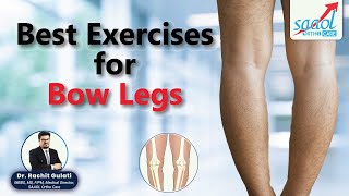 Top Exercises for Bow Legs  Treatment for varus deformity  D Rachit Gulati  SAAOL Ortho Care [upl. by Alyled]