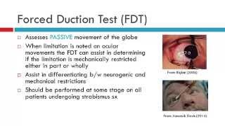 Forced Duction Test amp Force Generation Test [upl. by Guarino387]