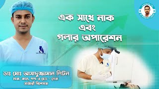 একইসাথে রোগীর নাক এবং গলার অপারেশন । Tonsillectomy। Septoplasty । Dr Assaduzzaman Liton [upl. by Ailsun]