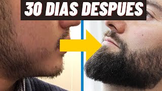 Las ÚNICAS Forma De Crecer La Barba En 30 Días [upl. by Eeldivad]