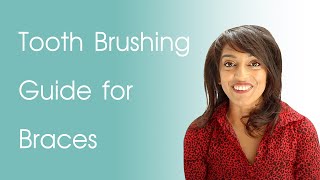 Braces Cleaning Routine  Tooth Brushing Guide for Braces [upl. by Kier804]