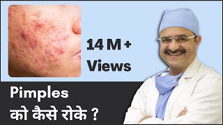 Pimples को कैसे रोके How to Prevent Pimples  2023  ClearSkin Pune  In HINDI [upl. by Stichter]