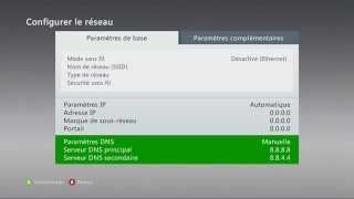 Explication et réglage des DNS sur Xbox [upl. by Nyleak]