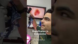 ¿Microscopio en Endodoncia Excelente alternativa para realizar tratamientos de conductos [upl. by Cartwell536]