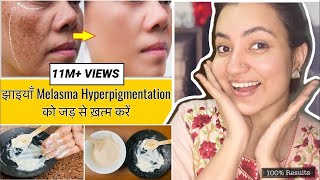 कितने भी मुश्किल झाइयाँ Hyperpigmentation Melasma काले धब्बे Spots हो इस Remedy से होगा 100 इलाज [upl. by Annayr]