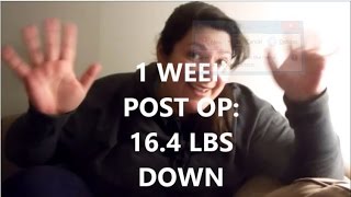 Gastric Sleeve VSG  1 Week PostOp  Back to Work [upl. by Annodahs970]