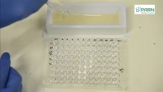 Dilution Methods of Antibiotic Susceptibility Testing [upl. by Alba]