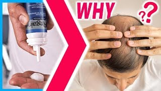 Hair Loss is the Same or Worse after Minoxidill 3 Reasons WHY [upl. by Ashok]