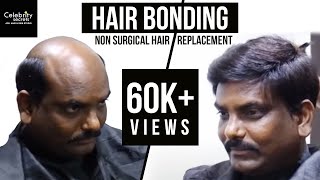 Hair Fixing Hyderabad  Hair Bonding  Non Surgical Hair Replacement Hyderabad [upl. by Magdalene107]