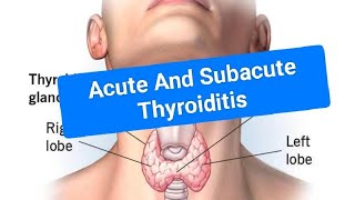 Acute and Subacute thyroiditis [upl. by Preciosa]