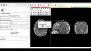 image registration in 3d slicer using general registration [upl. by Mundy]