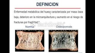 FSPTA 2022 Osteoporosis [upl. by Grindle]