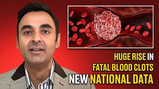 Huge rise in fatal Blood Clots New National Data [upl. by Sylvester259]