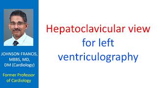 Hepatoclavicular view for left ventriculography [upl. by Oiramad]