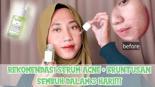 REVIEW SKINTIFIC 2 SALICYLIC ACID ANTI ACNE SERUM  SERUM UNTUK JERAWAT amp BRUNTUSAN [upl. by Benia]