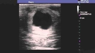 Twins Ultrasound at Upstate Equine Medical Center [upl. by Noskcire]