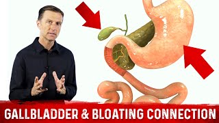 Gallbladder amp Bloating Connection Part 1 – DrBerg Bloated Stomach amp Gallbladder Function [upl. by Navanod]