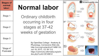 Normal labor ordinary delivery [upl. by Egief289]