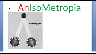 Ophthalmology AnIsoMetropia Simple Compound Mixed AnIsoMyopia AnIsoHyperMetropia AntiMetropia [upl. by Pattison]