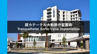 経カテーテル大動脈弁留置術 Transcatheter Aortic Valve Implantation TAVI [upl. by Adal599]