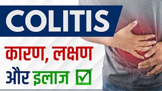 Colitis क्या होता है  Colitis के कारण लक्षण और इलाज [upl. by Nehte]