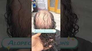 Gave her Curls Back w this Alopecia Hair Loss Solutions atlhairstylist alopeciastylist alopecia [upl. by Virgy]