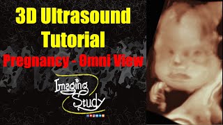 3D Ultrasound Tutorial Pregnancy  Omni View [upl. by Nolos450]