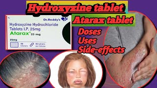 Atarax tablet Hydroxyzine  Hydroxyzine hydrochloride  Atarax 25 mg  Hicope 25 tablet [upl. by Hayyikaz]