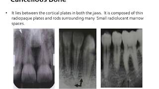 NORMAL RADIOGRAPHIC ANATOMICAL LANDMARKS [upl. by Rosane]