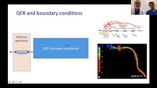 QFR influenced by microcirculatory dysfunction 2018 [upl. by Walczak]